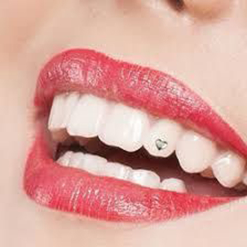 Sabbybeauty: Tooth Gems Service